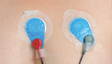 Holter elettrocardiogramma Anguillara Sabazia